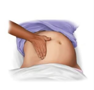 Cardiac Arrest in Pregnancy and Perimortem Caesarean Section: A Successful Outcome