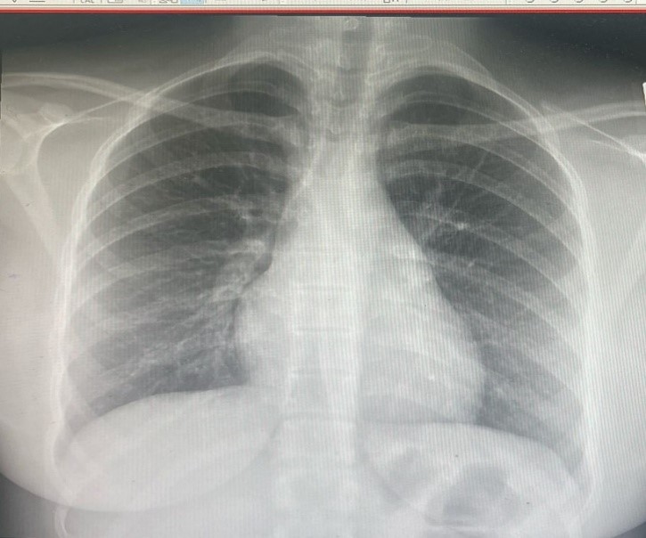 image missing